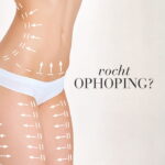 Illustratie van het lichaam met pijlen en de tekst "vochtophoping?".