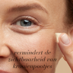 Close-up van een oog met crème, als illustratie van het verminderen van de zichtbaarheid van kraaienpootjes.