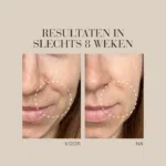 Voor-en-na vergelijking van de huid na 8 weken gebruik van Natural Magic™ Anti-Ageing Cream.
