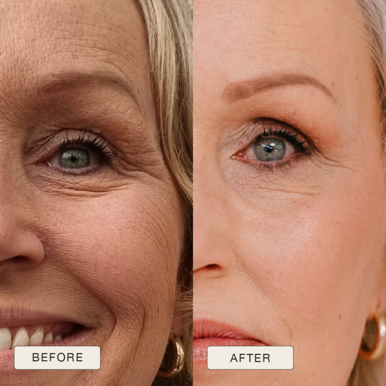 Testimonial van Alma met voor en na foto’s na gebruik van de Natural Magic™ skincare lijn.