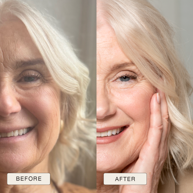 Testimonial van Anna met voor en na foto’s na gebruik van de Natural Magic™ skincare lijn.
