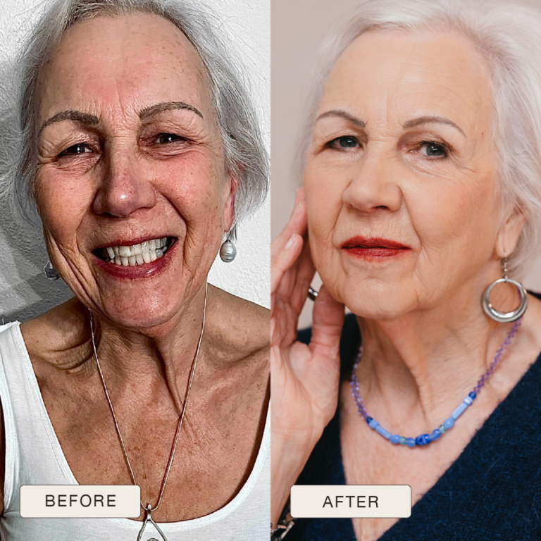 Testimonial van Antoinette met voor en na foto’s na gebruik van de Natural Magic™ skincare lijn.