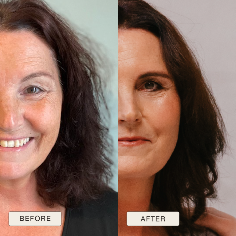 Testimonial van Barbara met voor en na foto’s na gebruik van de Natural Magic™ skincare lijn.