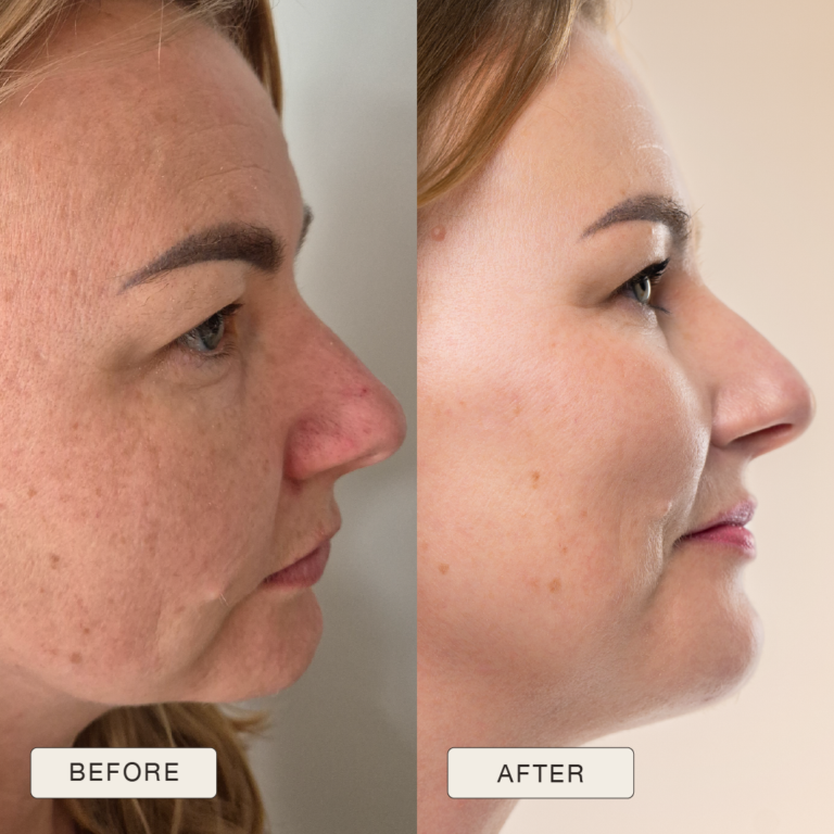 Testimonial van Beata met voor en na foto’s na gebruik van de Natural Magic™ skincare lijn.