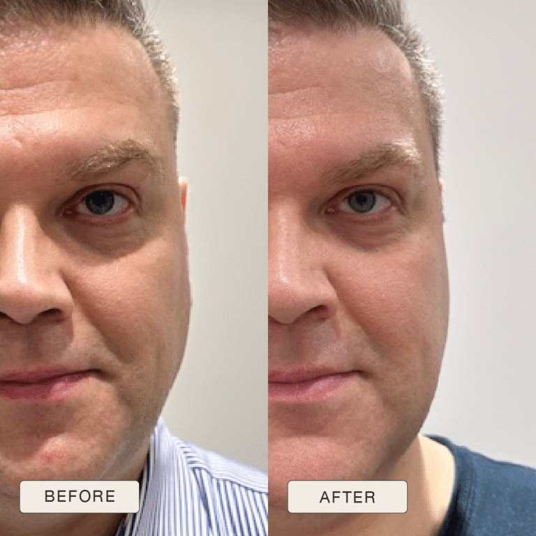 Testimonial van Eugenijus met voor en na foto’s na gebruik van de Natural Magic™ skincare lijn.