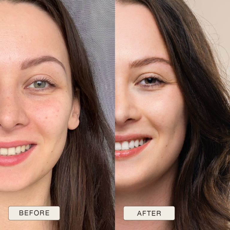 Testimonial van Karolina met voor en na foto’s na gebruik van de Natural Magic™ skincare lijn.