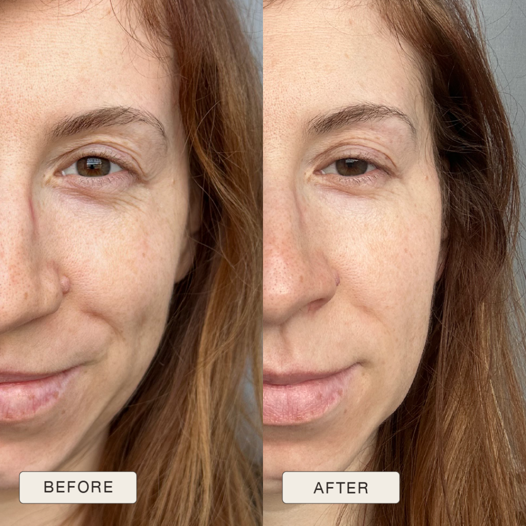 Testimonial van Patryija met voor en na foto’s na gebruik van de Natural Magic™ skincare lijn.