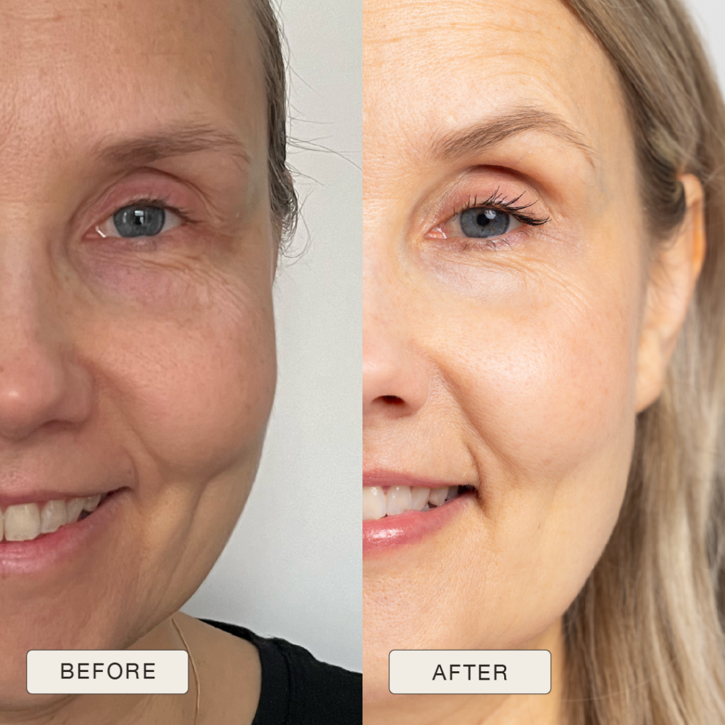 Testimonial van Teija met voor en na foto’s na gebruik van de Natural Magic™ skincare lijn.