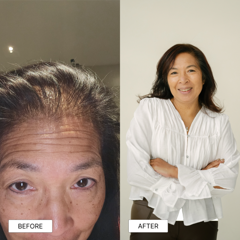 before after hairvolume